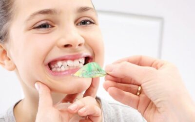 5 Benefits of Early Orthodontics