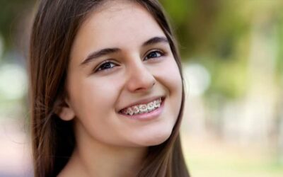 5 Quick Tips to Keep Your Braces Clean