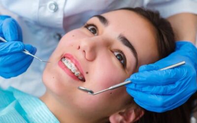Healthy Braces Start With a Trip to the Dentist